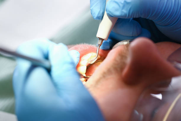 Best Emergency Denture Repair in Olmsted Falls, OH